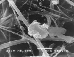 Scanning electron micrograph of a PM10 particle stuck to filter fibres.